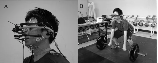 Fig. 2 Scatter plot of  ⊿ Pull and  ⊿ Down in the mandibular jaw movement during the deadlift