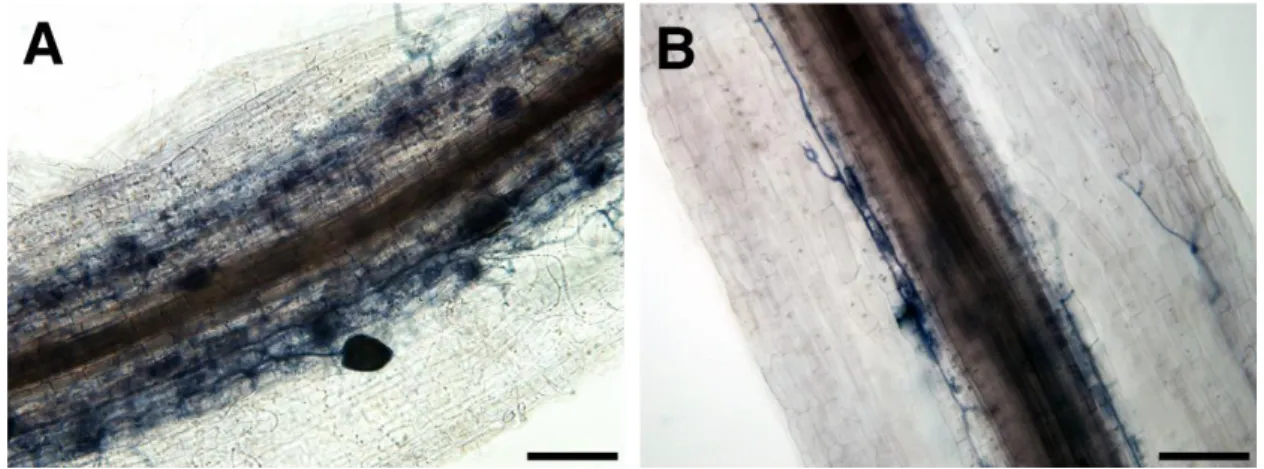図 12.  EV 毛状根と SIS1-HIGS 毛状根内の感染の様子 