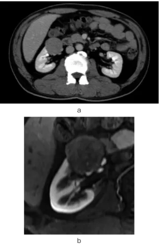 Fig. 2. Macroscopic appearance : the tumor was