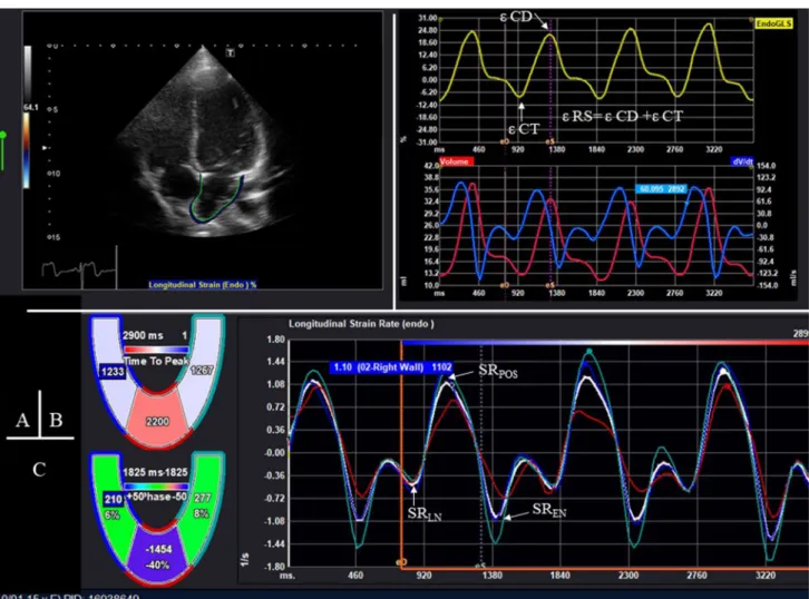 Fig. 2    LA functional analysis using the 2D speckle tracking method  obtained from an apical four-chamber view
