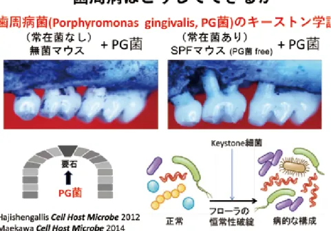 Fig. 8　 Periodontal disease is not an infection caused by a single periodontal disease bacterium (P.g.), but  an  infection  accompanied  by  destruction  of  alveolar  bone  caused  by  various  oral  bacteria