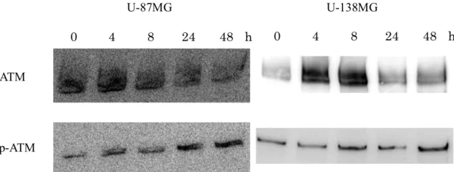 Figure 10. Ribavirin による ATM 、 phosphorylated ATM のタンパク発現の変化