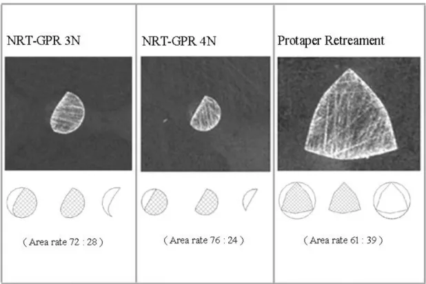 Fig.  6  Cross-section  of NRT-GPR  and  Protaper  Retreatment  instrument  at  D3 