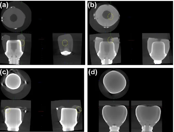 Fig. 8.  Representative micro-CT images before fracture resistance testing (original  magnification ×6.7): (a) PLZ, (b) ILZ, (c) MC, and (d) MONO groups