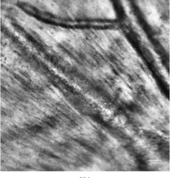 図 1　正常網膜動静脈．29 歳女性（scale bar 100 micron） 図 2　網膜中心動脈閉塞症．70歳男性（scale bar 100 micron）
