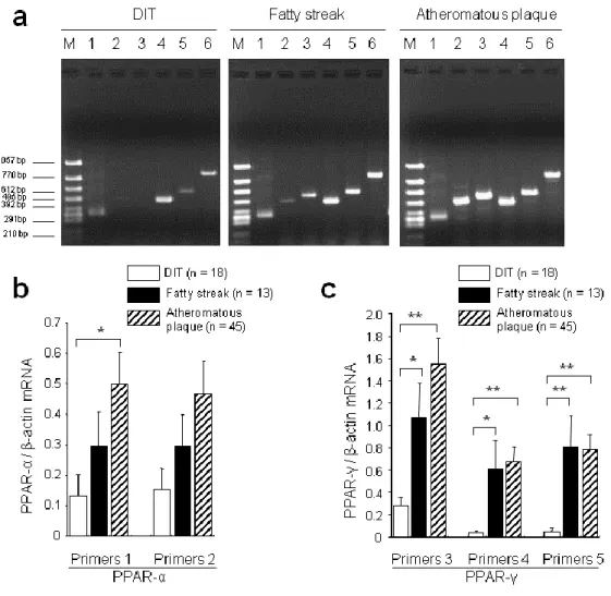 Figure 2.    Expression of PPAR-α and PPAR-γ mRNA in human aortas.   