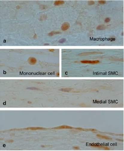 Figure 5.    Localizat ion of the PPAR-γ protein in the aorta.   