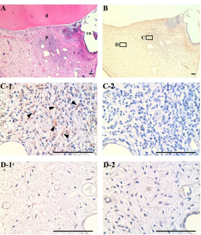 Fig. 4. Immunohistochemical localization of MIF in human teeth affected by pulpitis. 