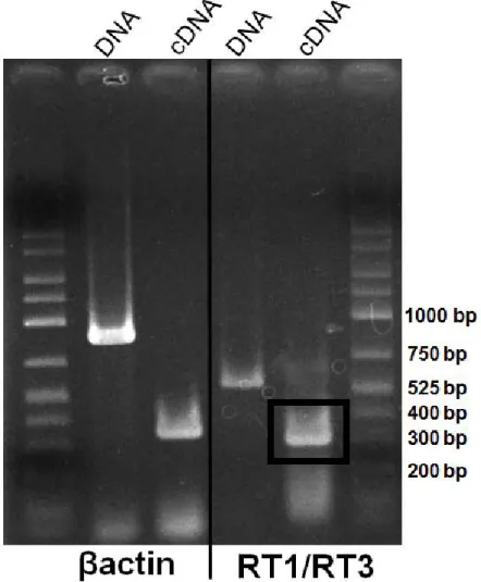 図 2-5 RT-PCR 法による MHC クラス II 遺伝子発現解析．
