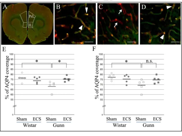 Fig. 3. Effect of ECS on the astrocfigytic-endfoot coverage of blood vessels in the medial prefrontal cortex of normal rats and Gunn rats