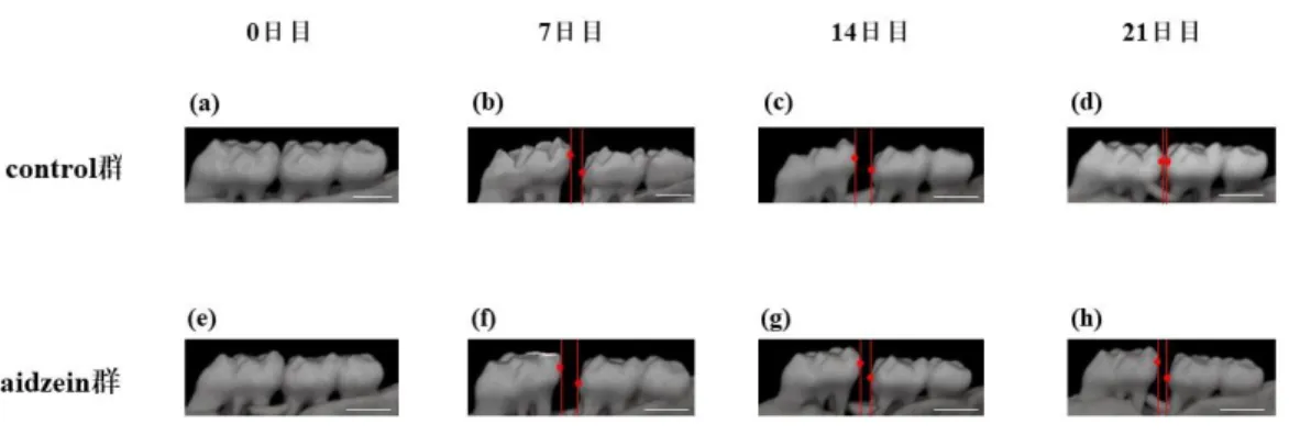 Fig. 6 micro-CT 撮影による歯の移動量の変化
