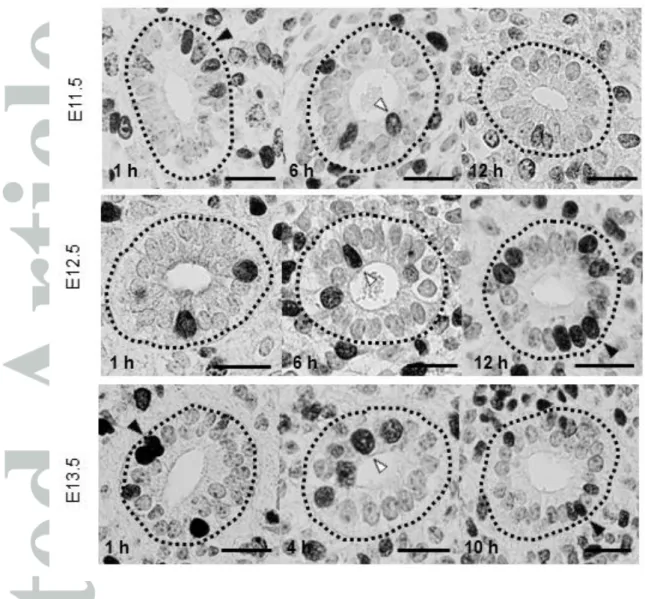 Fig.  3  Images  of  BrdU-labeled  ureteric  epithelial  cells.  Black  arrowheads  represent  typical  basally  positioned  cells  with  BrdU,  whereas  white  arrowheads  indicate  typical  apically positioned cells