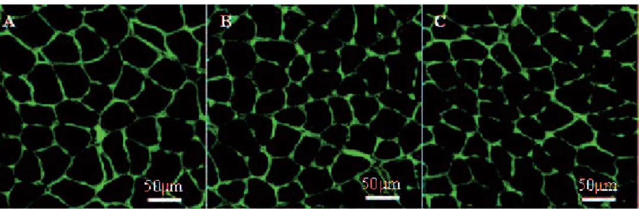 Figure 2 Images of muscle fibers in the young soleus muscle stained by laminin (green) from the N  group (A), H group (B), and IH group (C)