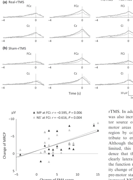 Figure 3 MRCP generated by aﬀected hand movement at six electrode sites before (grey) and after (black) rTMS for (a) the real group and (b) the sham group