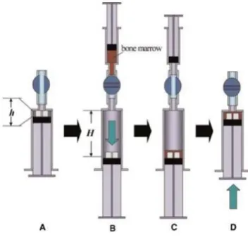図 4. ULP (Under Low Pressure)法  Yoshii et al. 29 引用  (A)  TCP/Collagen複合体を10 mlシリンジにセットする。  (B)  三方活栓を閉じた状態で10 mlまで内筒を引いて陰圧をかける。  (C)  用意しておいたツベルクリン針に入れたDFATを三方活栓を開けて、陰圧を かけたシリンジ内へ播種する。  (D)三方活栓を閉め、注意深くタッピングした後に内筒を元に戻す。       