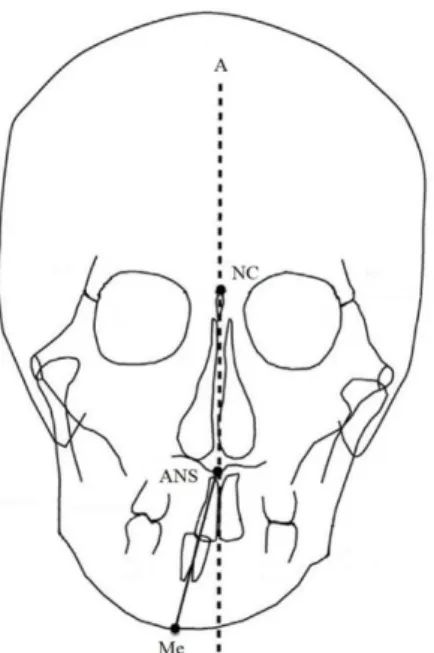 Fig. 1  前頭部のセファログラム上の基準点と測定点
