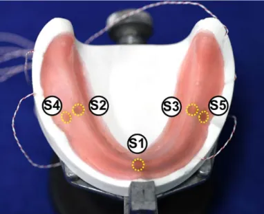 Fig. 4  Overview  of  sensor  installation  sites  in  a  clinical  edentulous  mandible  simulation  model