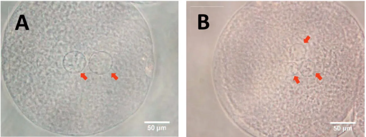 Figure 2.1. Pronucleus(ei) in  zygotes  at 10 hr  after  IVF. A monopsermic (A)  and a  polyspermic (B) zygote