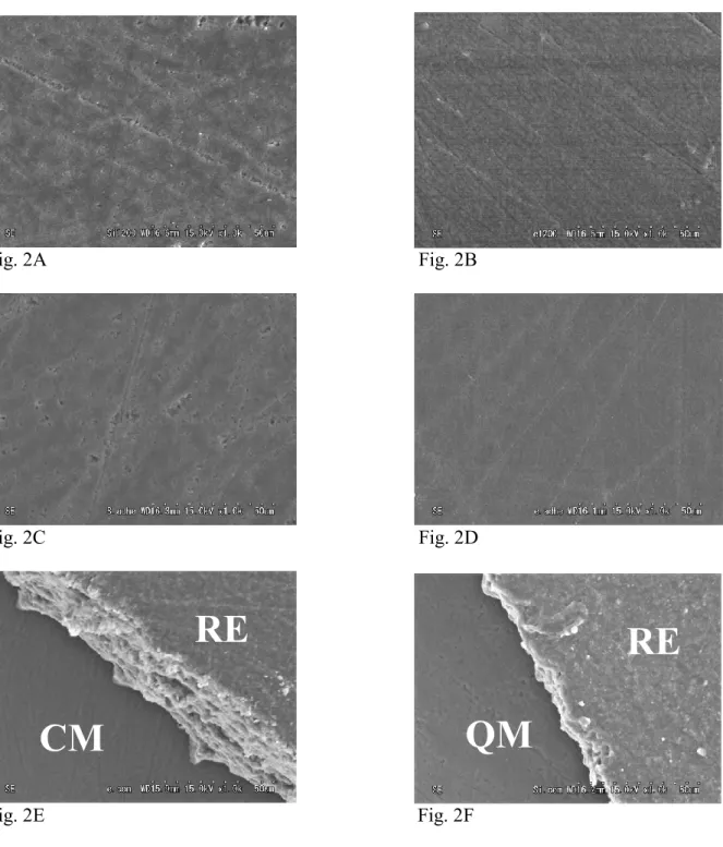 Fig. 2  SEM image of (A): a ceramic material surface after grinding, (B): a quartz material  surface after grinding, (C): a ceramic material surface exhibiting adhesive failure after shear  bond testing, (D): a quartz material surface exhibiting adhesive f