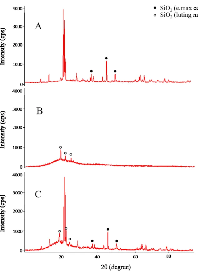 Fig. 3    XRD diffraction patterns of (A) an e.max ceramic material, (B) a resin-based luting  agent, and (C) an e.max specimen exhibiting combination adhesive/cohesive failure after  shear bond testing