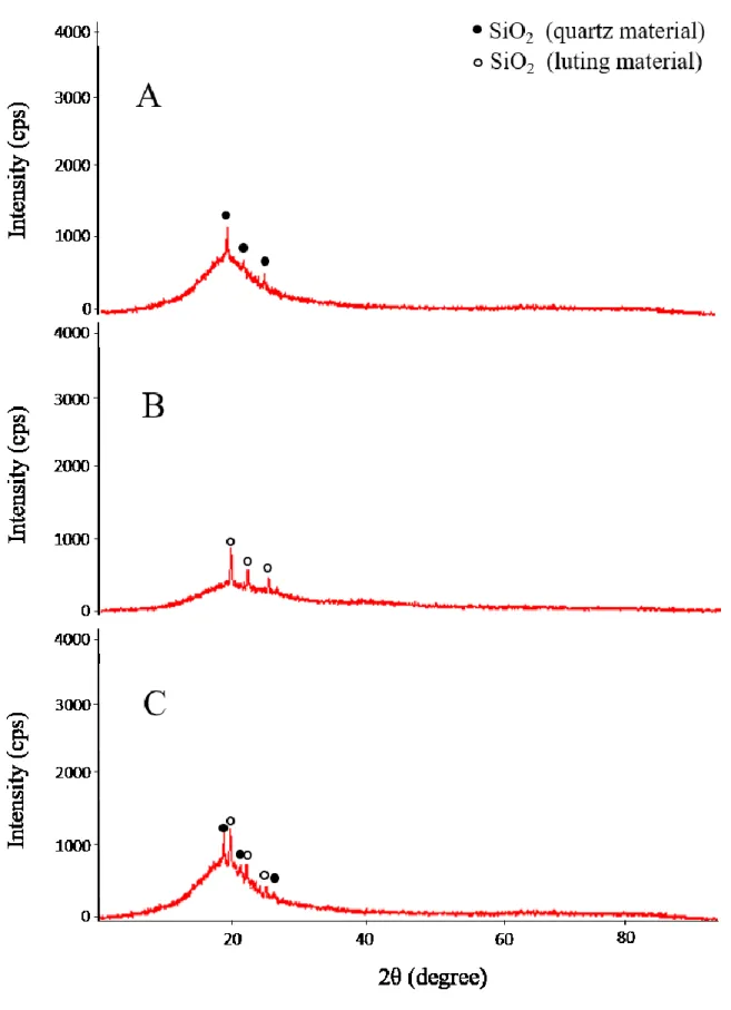 Fig. 4  XRD diffraction patterns of (A) a quartz material, (B) a resin-based luting agent,  and (C) a quartz material specimen exhibiting combination adhesive/cohesive failure after  shear bond testing