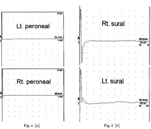 Fig. 4.  Nerve  conduction studies.  Absence  of  action  potential  was  observed  in  the  bilateral  peroneal  motor  nerves  [a]  and  the  bilateral  sural  sensory  nerves  [b]