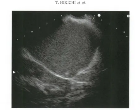Fig. 2.  EUS  image.  The  pancreatic pseud ocyst showed  no  wall  thickening and  had  a  granular  echo  pattern  with  re lative ly  uniform  inner  echo density