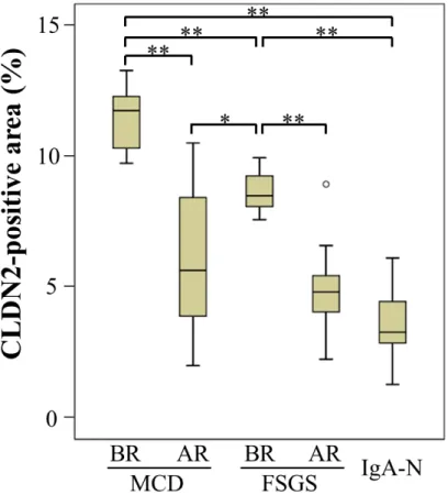Figure 2: The CLDN2-positive area is increased in MCD and FSGS glomeruli. 