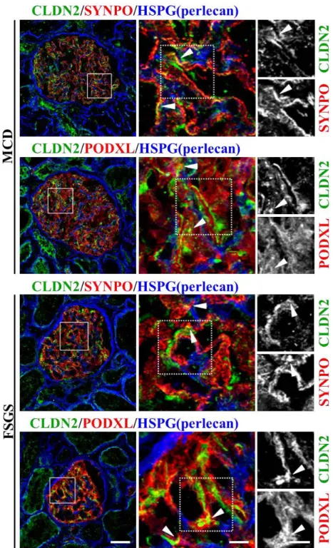 Figure 3: CLDN2 is at least partially colocalized with the podocyte markers 469 