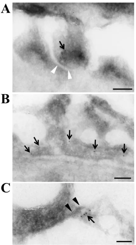 Figure 4: Immunogold electron micrographs showing the presence of CLDN2 in 477 