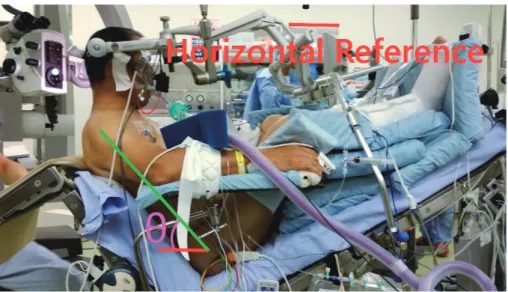 Fig. 1.  Horizontal baseline in the background and the head elevation angle     Red lines : horizontal reference in the background