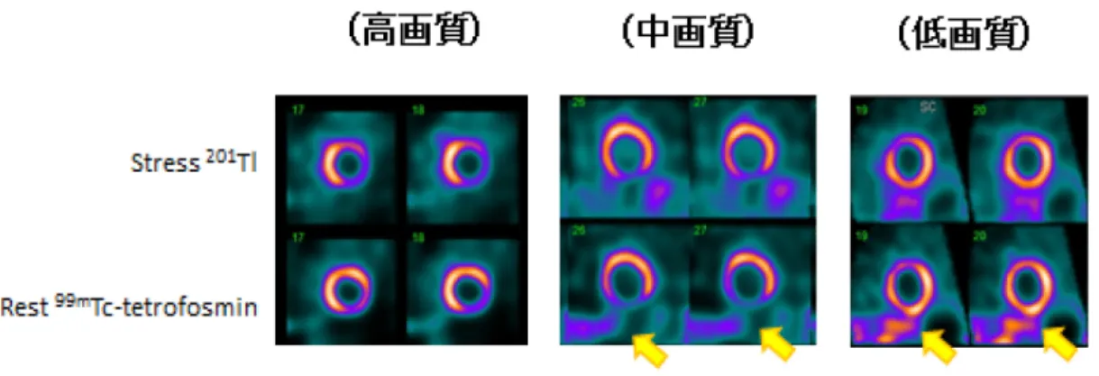 図 12 ）画像評価の典型的画像