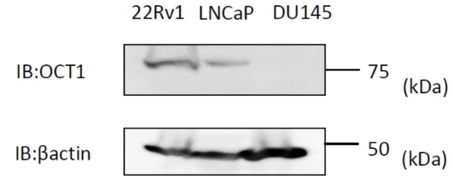 図 4  前立腺癌細胞での OCT1 発現量の検討 