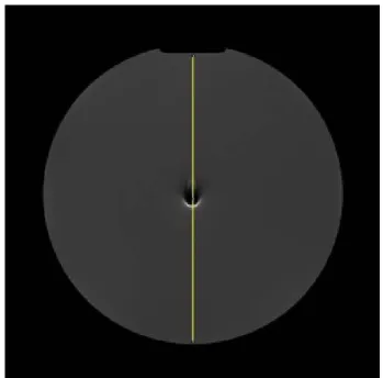 Figure 2    An example of measurement of signal intensity area including the largest sizes 