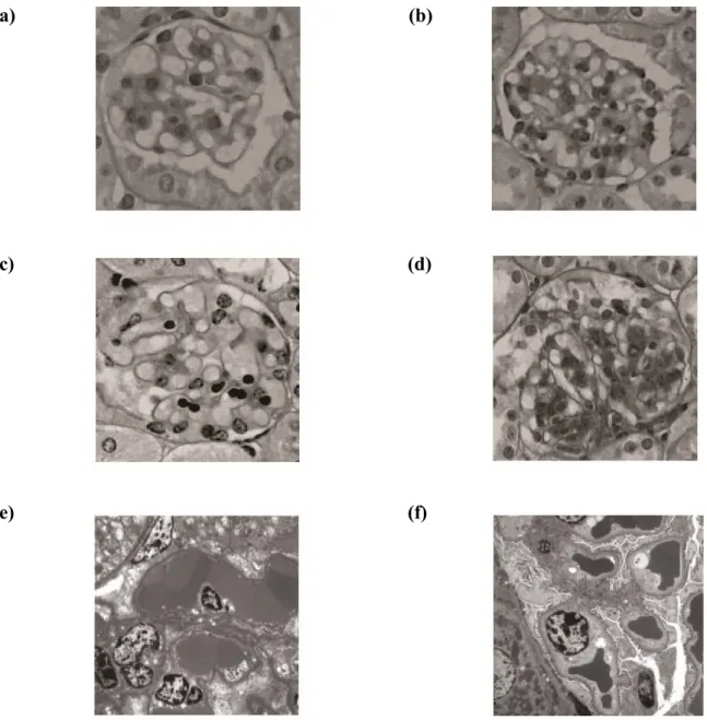 Figure 4: The effect of administration of various compounds on LM and EM findings in the murine  model of tHUS