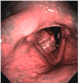 Fig. 1.  Microscopic findings of the reseted speci- speci-mens.  a. sigmoid colon, b. lungs, c
