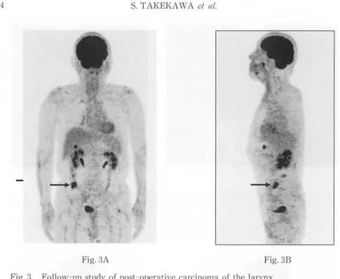 Fig. 3A  Fig.  38 