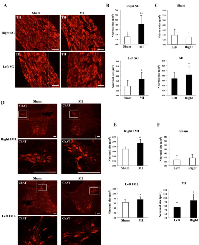 Fig. 1. Neuronal cell body hypertrophy in SG and IML 2 weeks after MI.   