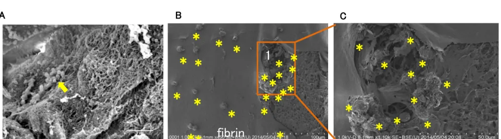Figure 9. fibrin gelの観察（走査電子顕微鏡写真) * * * * * * * * ** *A fibrin* 1** * ****** * * ******* ***B C