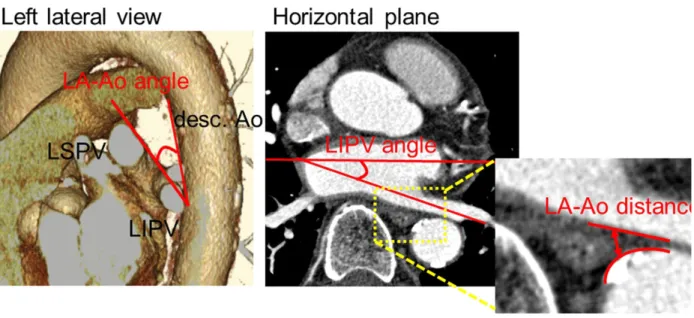 Fig. 1 The parameters used to evaluate the proximities of the esophagus to its surrounding  structures on the computed tomography data