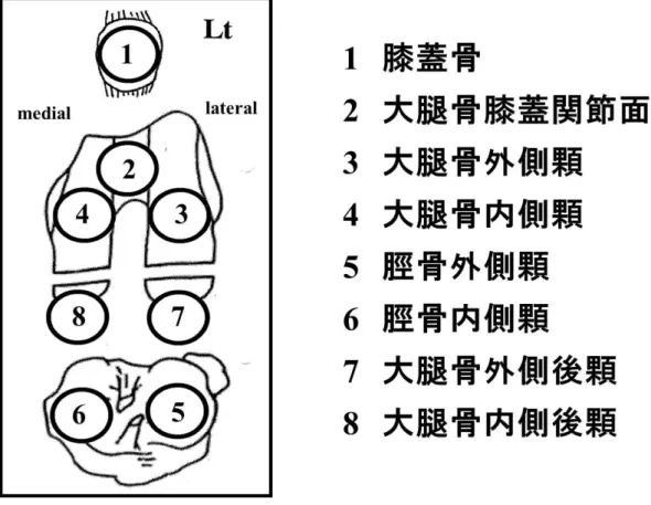 図 3：膝関節内関節面の分割図 