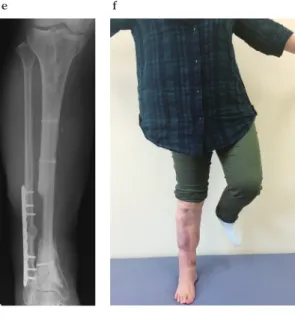 Fig. 2 .　 Case 1.