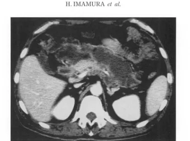 Fig. 5.  Abdomina l  CT  revea led  exte nsively  developed  abscesses  in  case 2. 