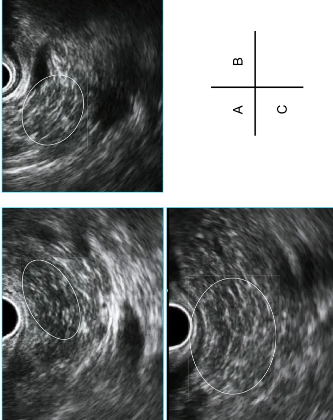 Figure 2 AB C