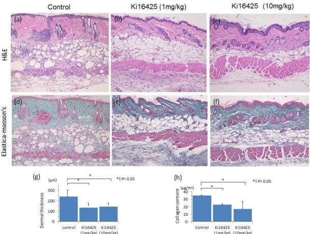 Figure 1.    Histopathological evaluation of the skin of bleomycin induced mice treated  with (a, d) oil, (b, e) Ki16425 (1 mg/kg) , (c, f) Ki16425 (10 mg/kg) for 4 weeks by  H&amp;E  (a-c)  and  Elastica-masson’s  staining  (d-f)