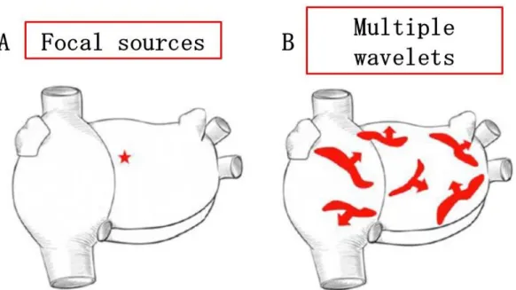 図 1  心房細動の発生機序   