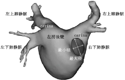 図 7 肺静脈入口部径