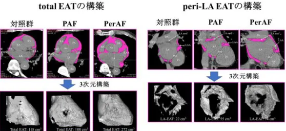 図 6    3D CT による EAT 容積の計測