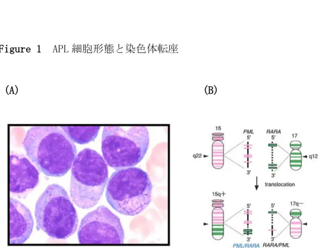 Figure 1  APL 細胞形態と染色体転座 