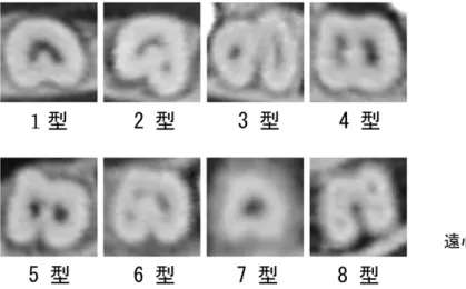 Fig. 2  断面での根管形態